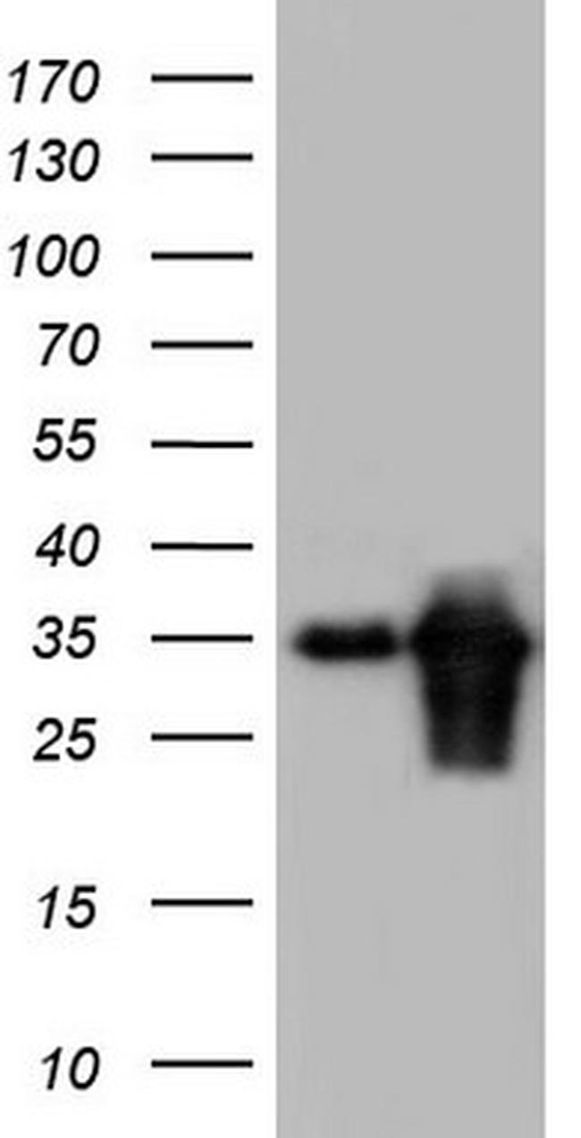 TACC2 Antibody in Western Blot (WB)