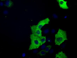 TACC3 Antibody in Immunocytochemistry (ICC/IF)