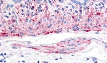 TACR2 Antibody in Immunohistochemistry (Paraffin) (IHC (P))