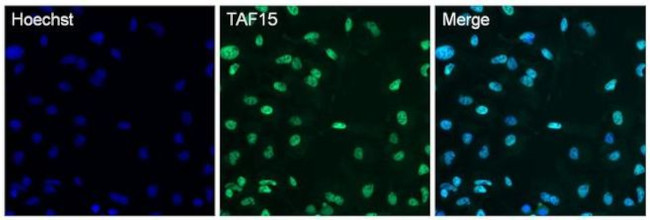 TAF15 Antibody in Immunocytochemistry (ICC/IF)