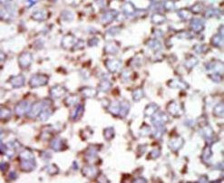 TAK1 Antibody in Immunohistochemistry (IHC)