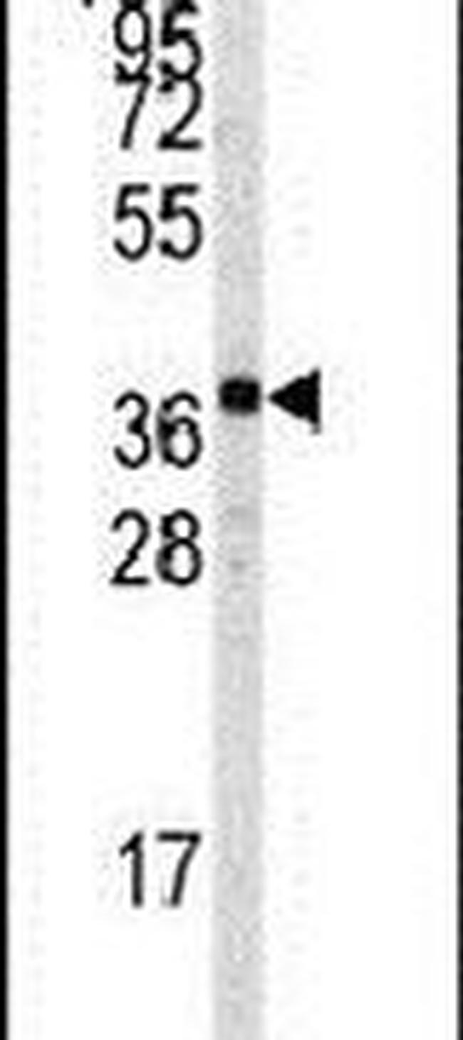 TAL1 Antibody in Western Blot (WB)