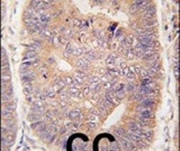 TASP1 Antibody in Immunohistochemistry (IHC)
