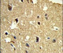 beta Tubulin Antibody in Immunohistochemistry (IHC)