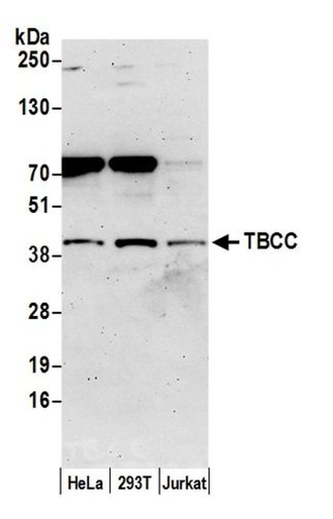 TBCC Antibody in Western Blot (WB)