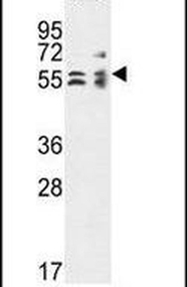 TBCE Antibody in Western Blot (WB)