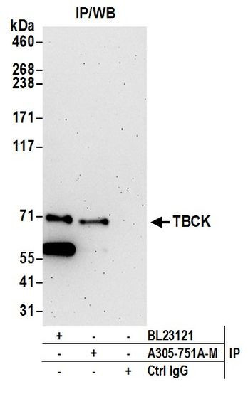 TBCK Antibody in Immunoprecipitation (IP)