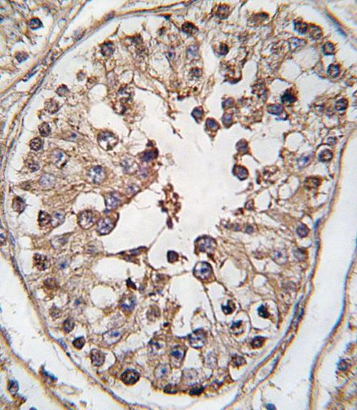 TBK1 Antibody in Immunohistochemistry (IHC)