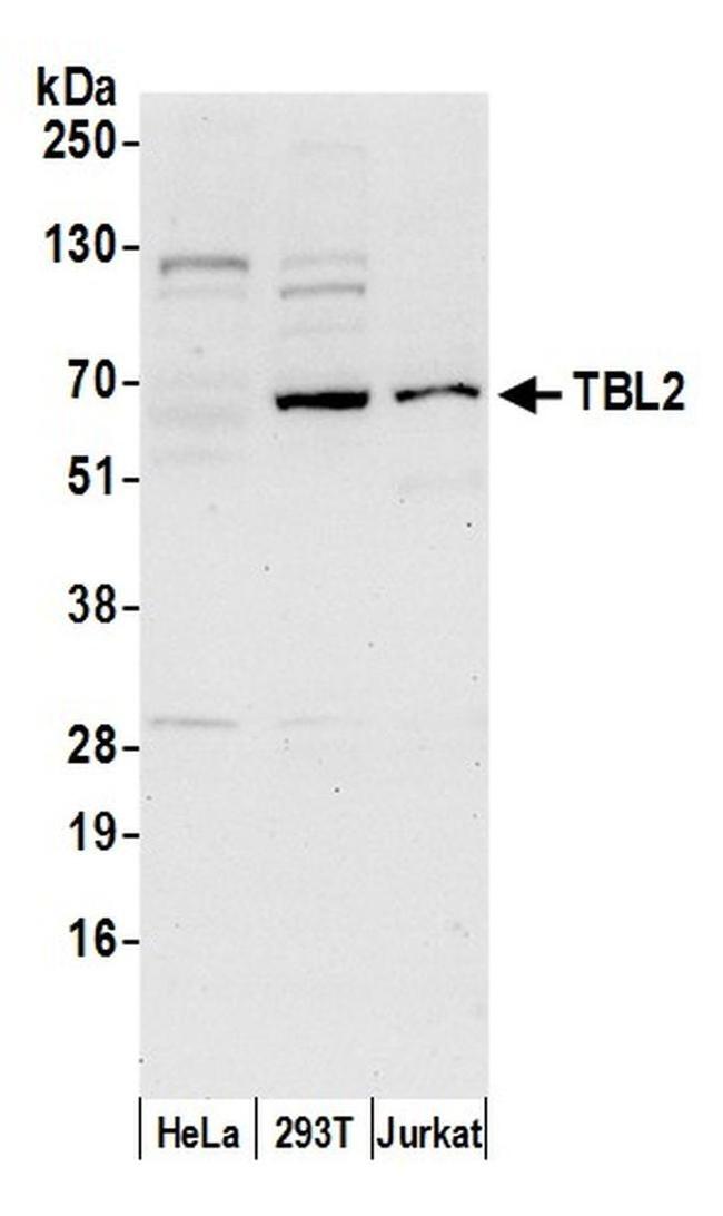 TBL2 Antibody in Western Blot (WB)