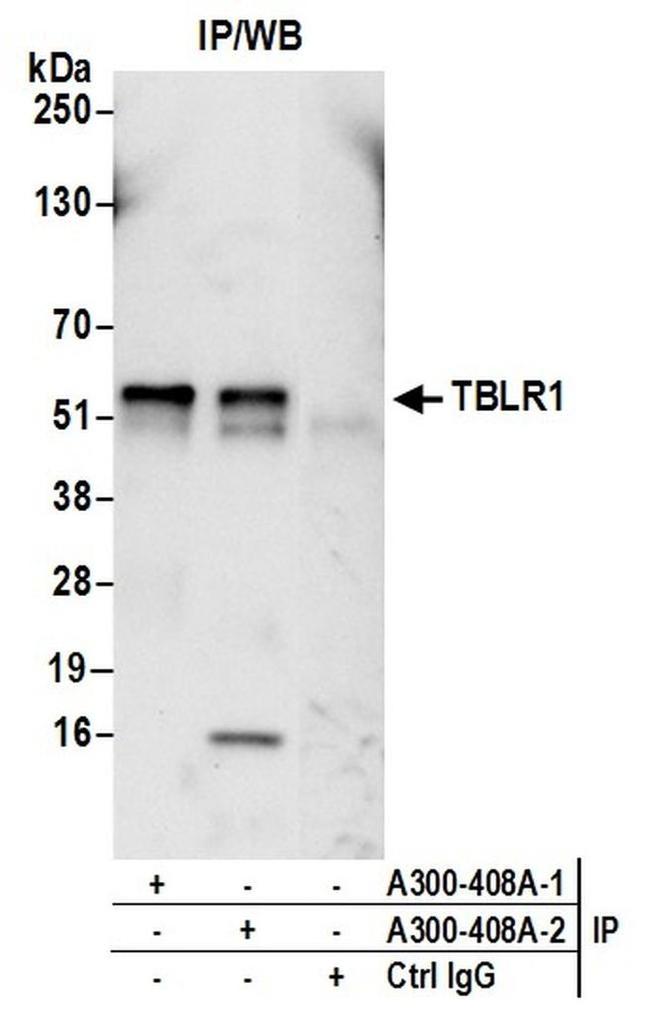 TBLR1 Antibody in Western Blot (WB)