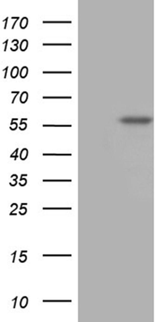 TBX20 Antibody in Western Blot (WB)