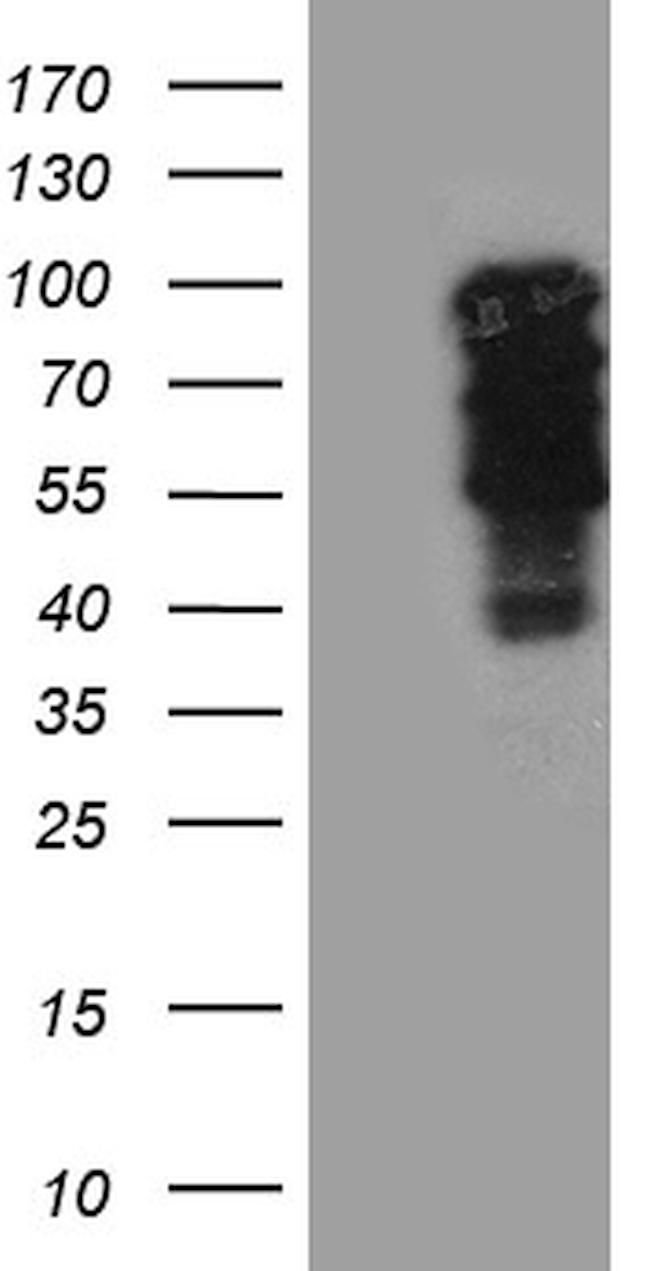 TBX3 Antibody in Western Blot (WB)