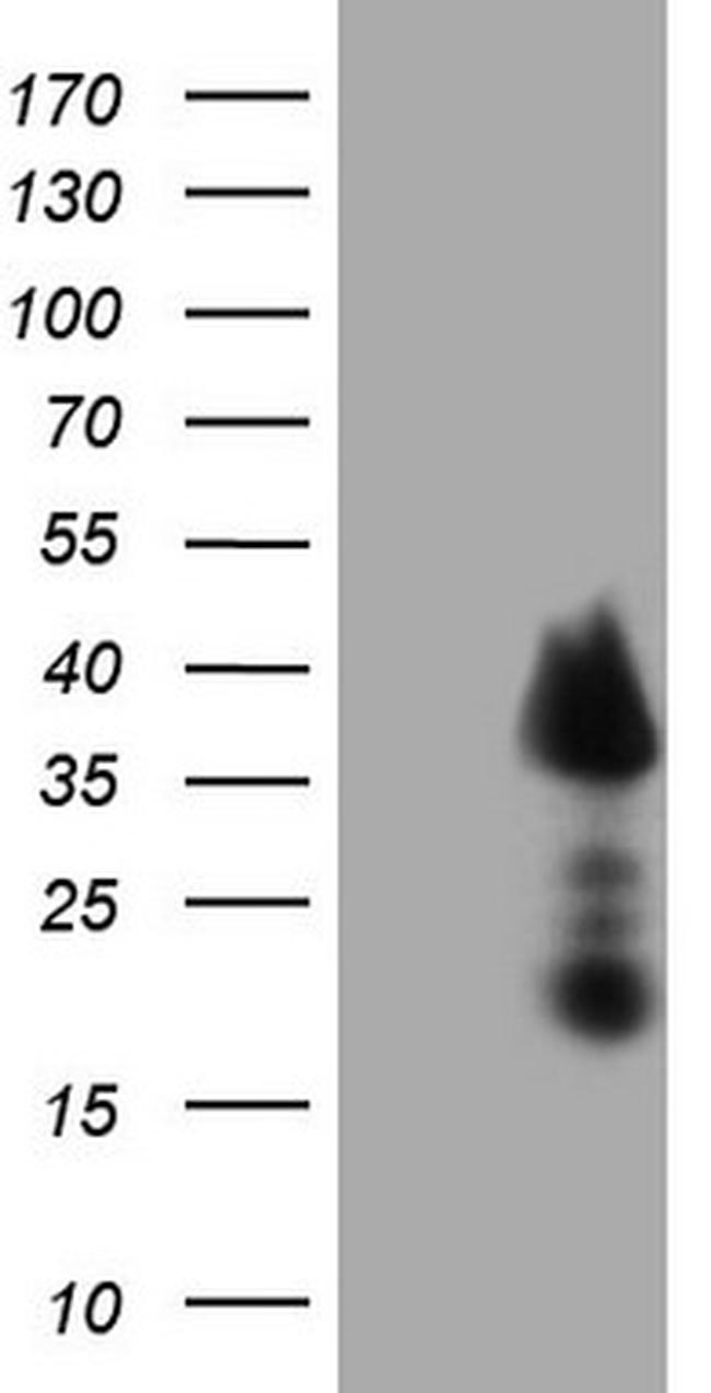 TCEAL1 Antibody in Western Blot (WB)
