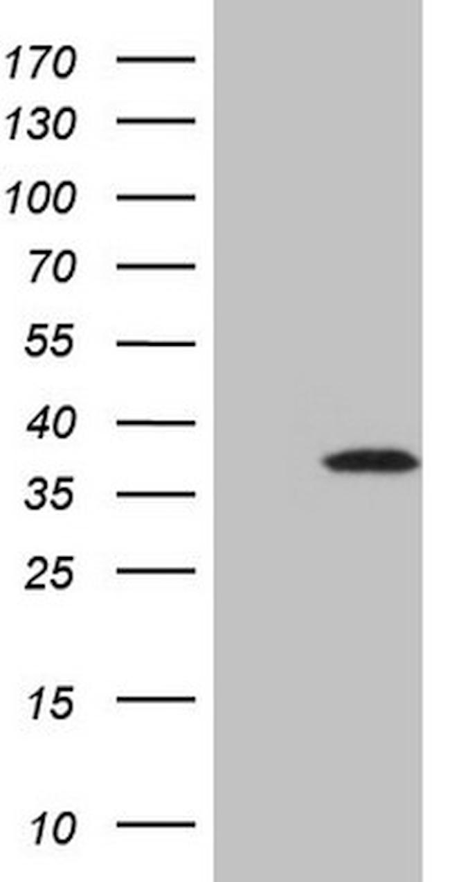TCEAL1 Antibody in Western Blot (WB)