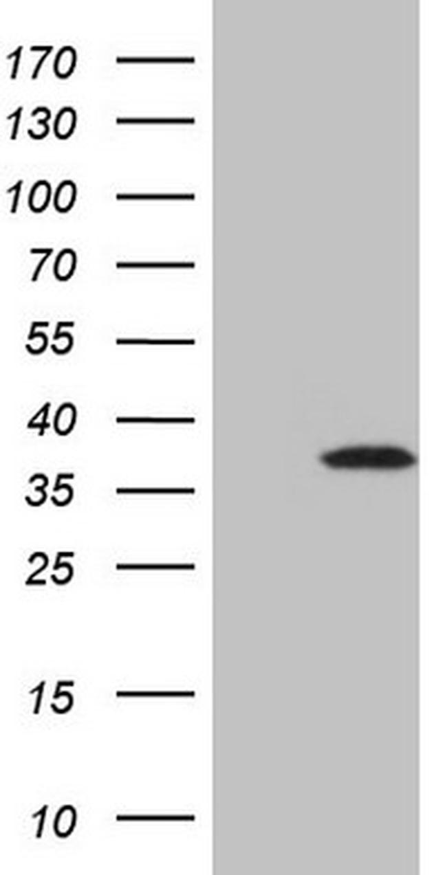 TCEAL1 Antibody in Western Blot (WB)
