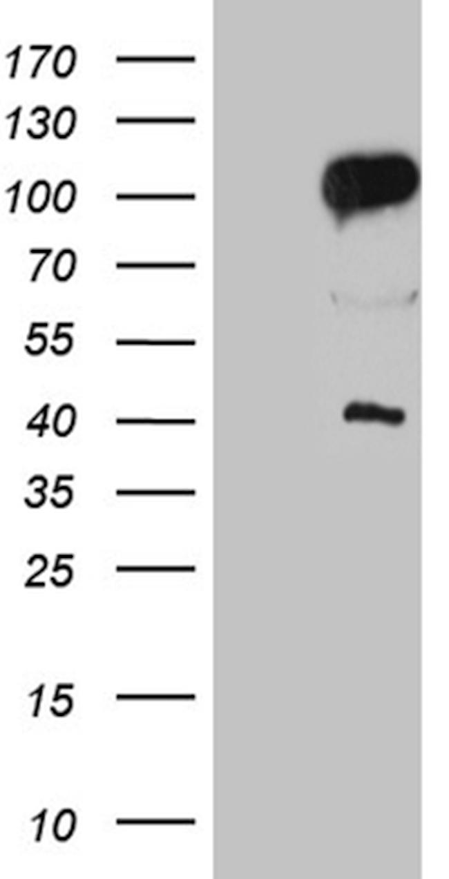 TCF12 Antibody in Western Blot (WB)