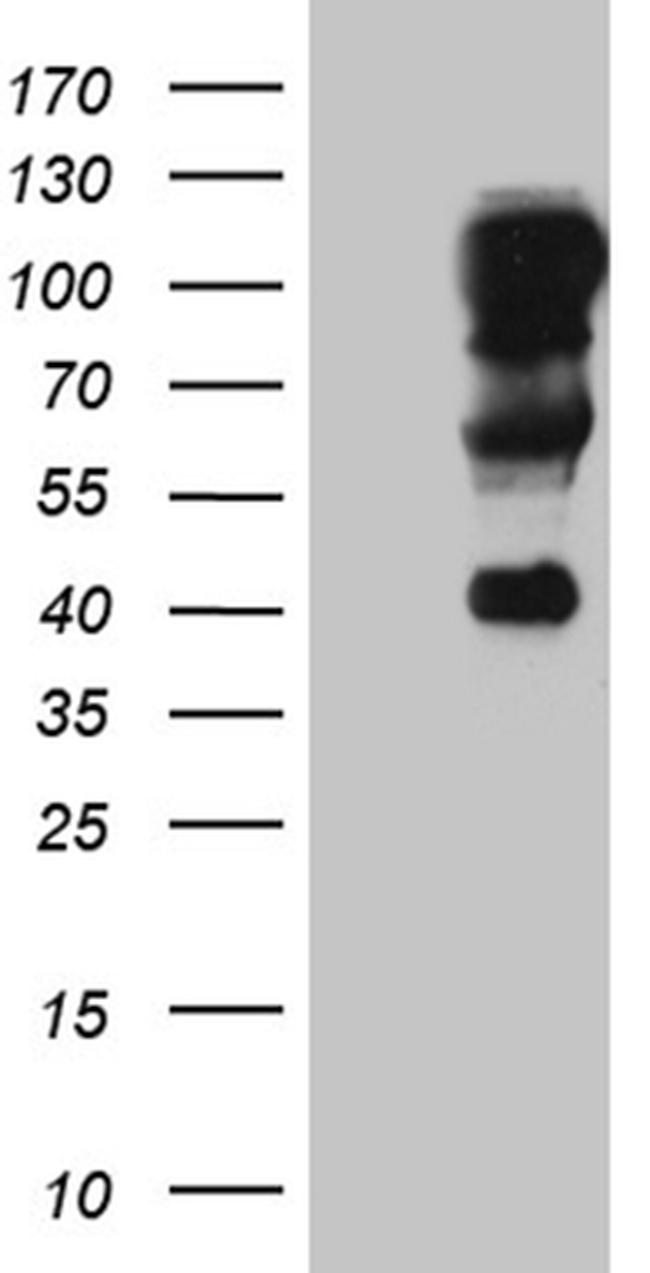 TCF12 Antibody in Western Blot (WB)