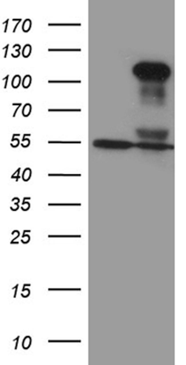 TCF12 Antibody in Western Blot (WB)