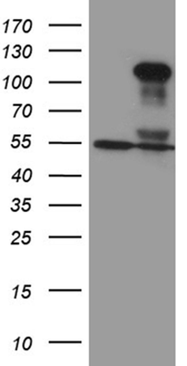 TCF12 Antibody in Western Blot (WB)