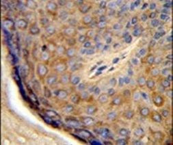 TCHP Antibody in Immunohistochemistry (IHC)