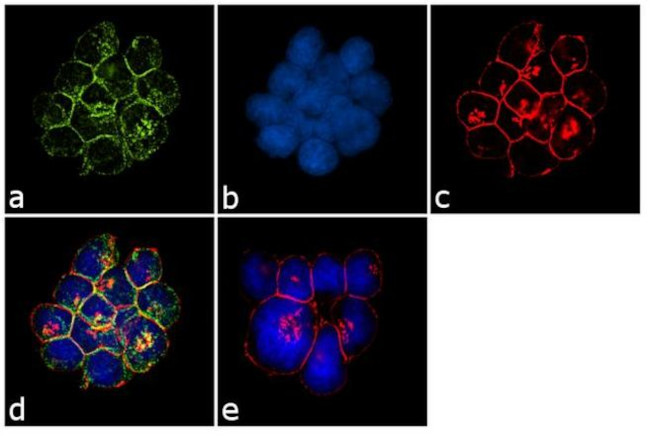 TCR V beta 8a Antibody in Immunocytochemistry (ICC/IF)