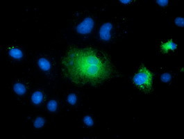 TCTN2 Antibody in Immunocytochemistry (ICC/IF)