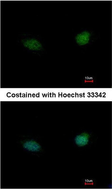 TDP1 Antibody in Immunocytochemistry (ICC/IF)