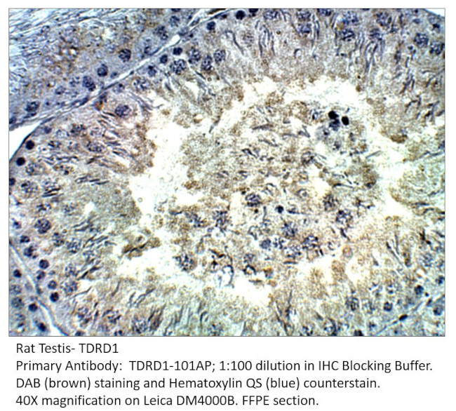 TDRD1 Antibody in Immunohistochemistry (IHC)