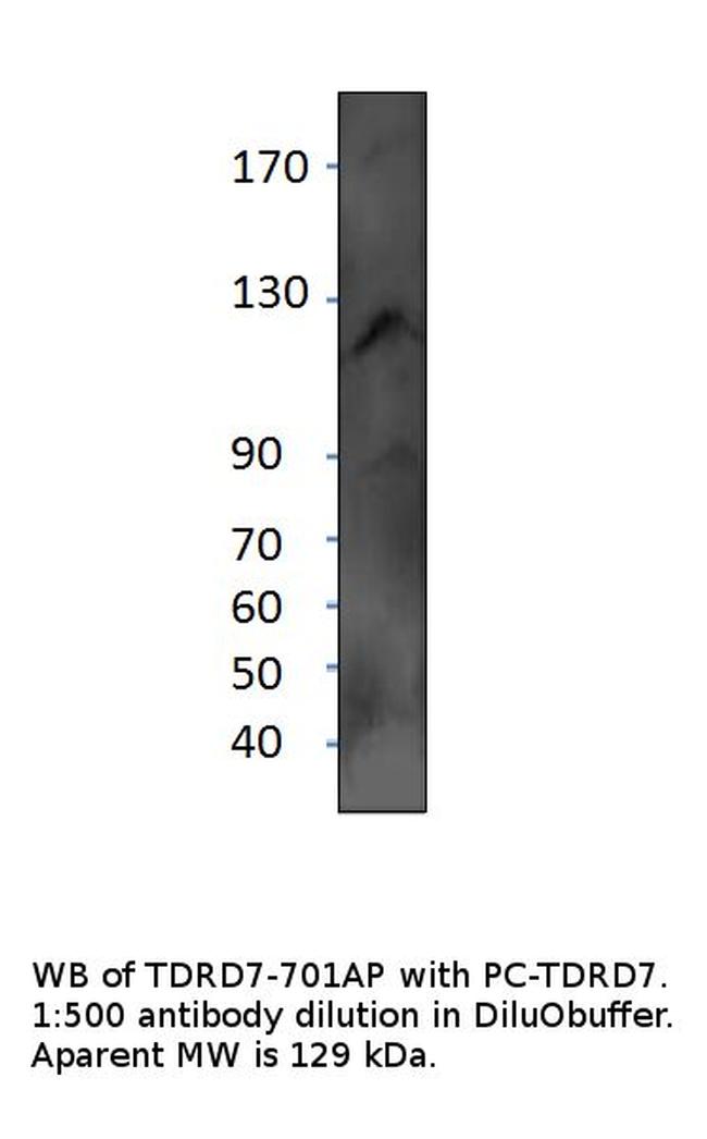 TDRD7 Antibody in Western Blot (WB)
