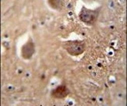 TDRD7 Antibody in Immunohistochemistry (IHC)