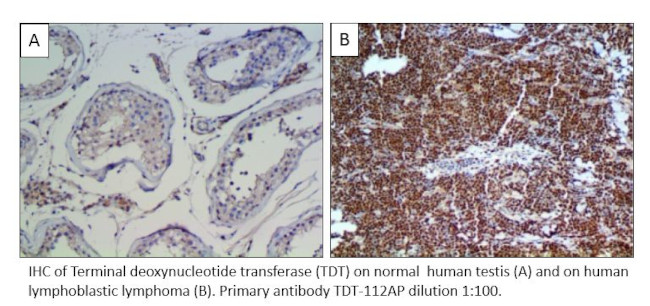 TdT Antibody in Immunohistochemistry (IHC)