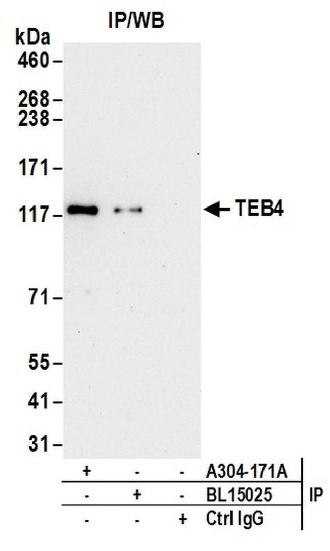 TEB4 Antibody in Western Blot (WB)