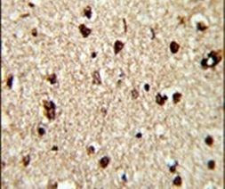 TECPR1 Antibody in Immunohistochemistry (IHC)