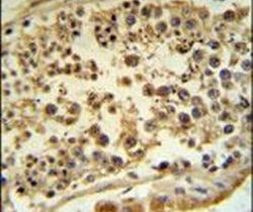 TCTN1 Antibody in Immunohistochemistry (IHC)