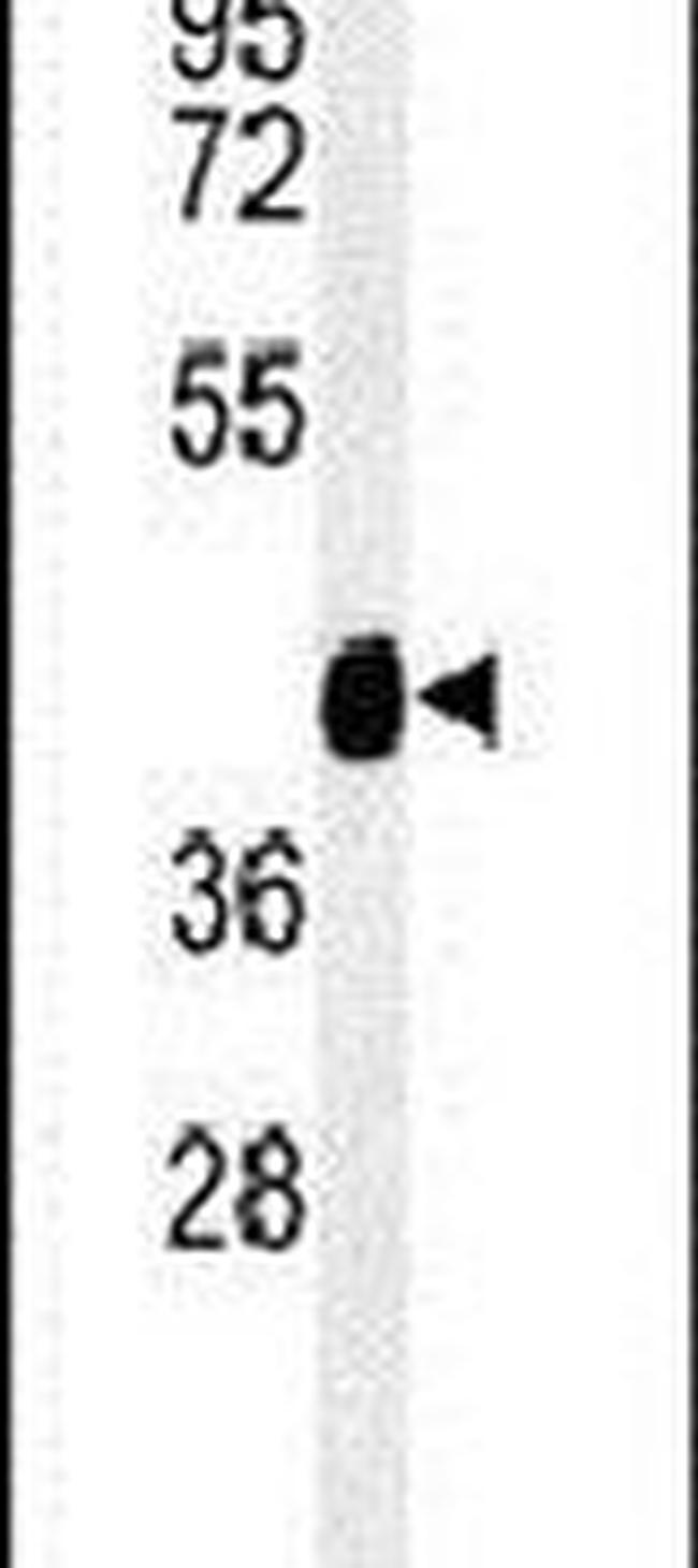 TEKT4 Antibody in Western Blot (WB)