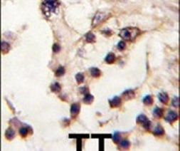 TESK2 Antibody in Immunohistochemistry (IHC)