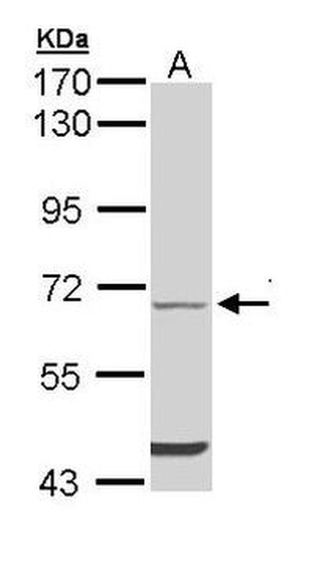 TESK2 Antibody in Western Blot (WB)