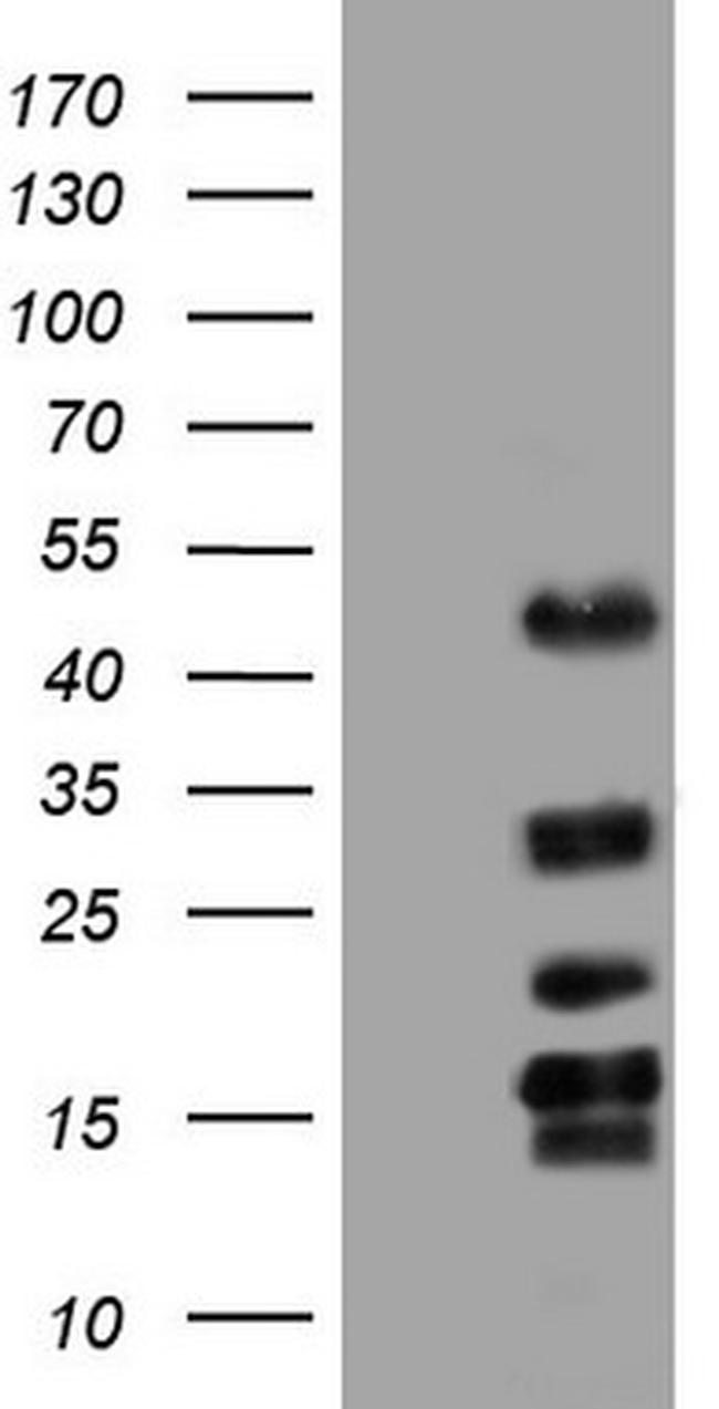 TET3 Antibody in Western Blot (WB)