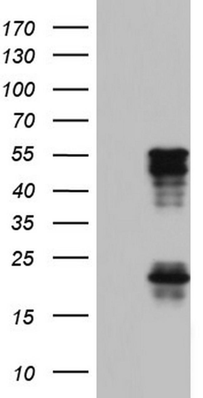 TET3 Antibody in Western Blot (WB)