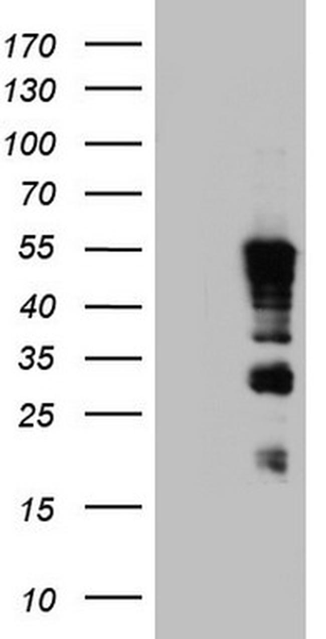 TET3 Antibody in Western Blot (WB)