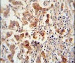 TEX13B Antibody in Immunohistochemistry (IHC)