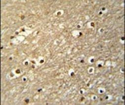 TFAP4 Antibody in Immunohistochemistry (IHC)