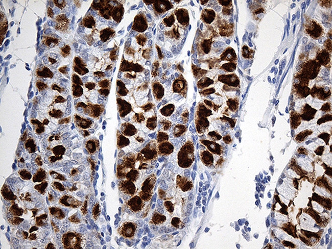 TFF1 Antibody in Immunohistochemistry (Paraffin) (IHC (P))