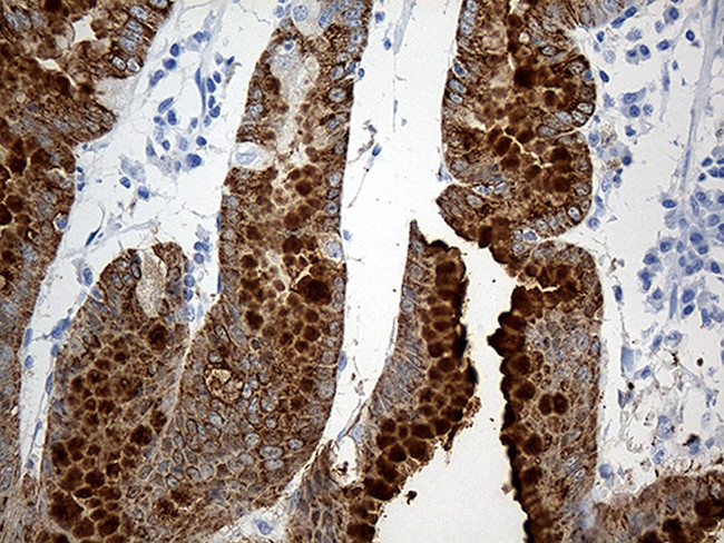 TFF1 Antibody in Immunohistochemistry (Paraffin) (IHC (P))
