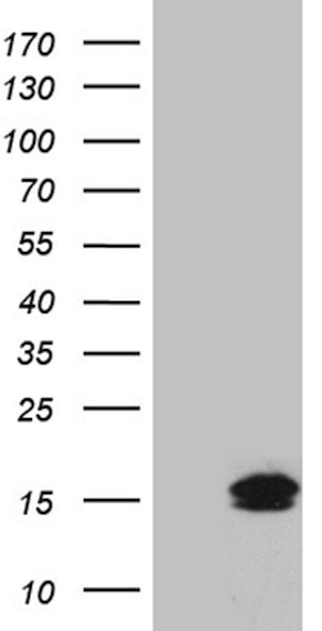 TFF3 Antibody in Western Blot (WB)