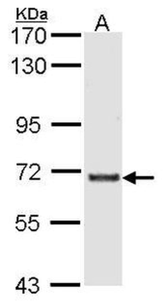 GTF3C2 Antibody in Western Blot (WB)
