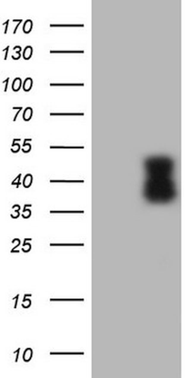 TFPI Antibody in Western Blot (WB)