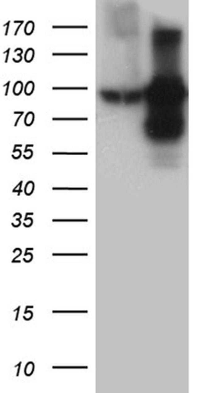 TFRC Antibody in Western Blot (WB)