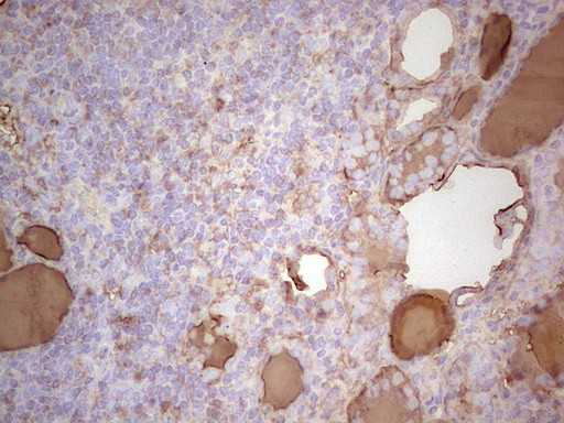 TG Antibody in Immunohistochemistry (Paraffin) (IHC (P))