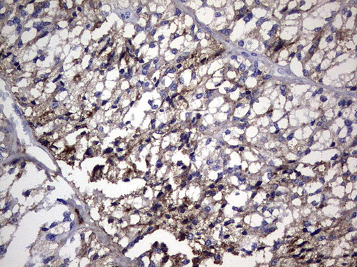 TG Antibody in Immunohistochemistry (Paraffin) (IHC (P))